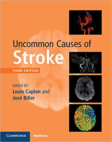 Uncommon Causes of Stroke  2018 - نورولوژی